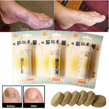 

Fungal Nail Treatment Detox Foot Soak Long-Term Relief Athlete's Foot,Foot Skin Cracking,Psoriasis,Peeling,Beriberi drop ship