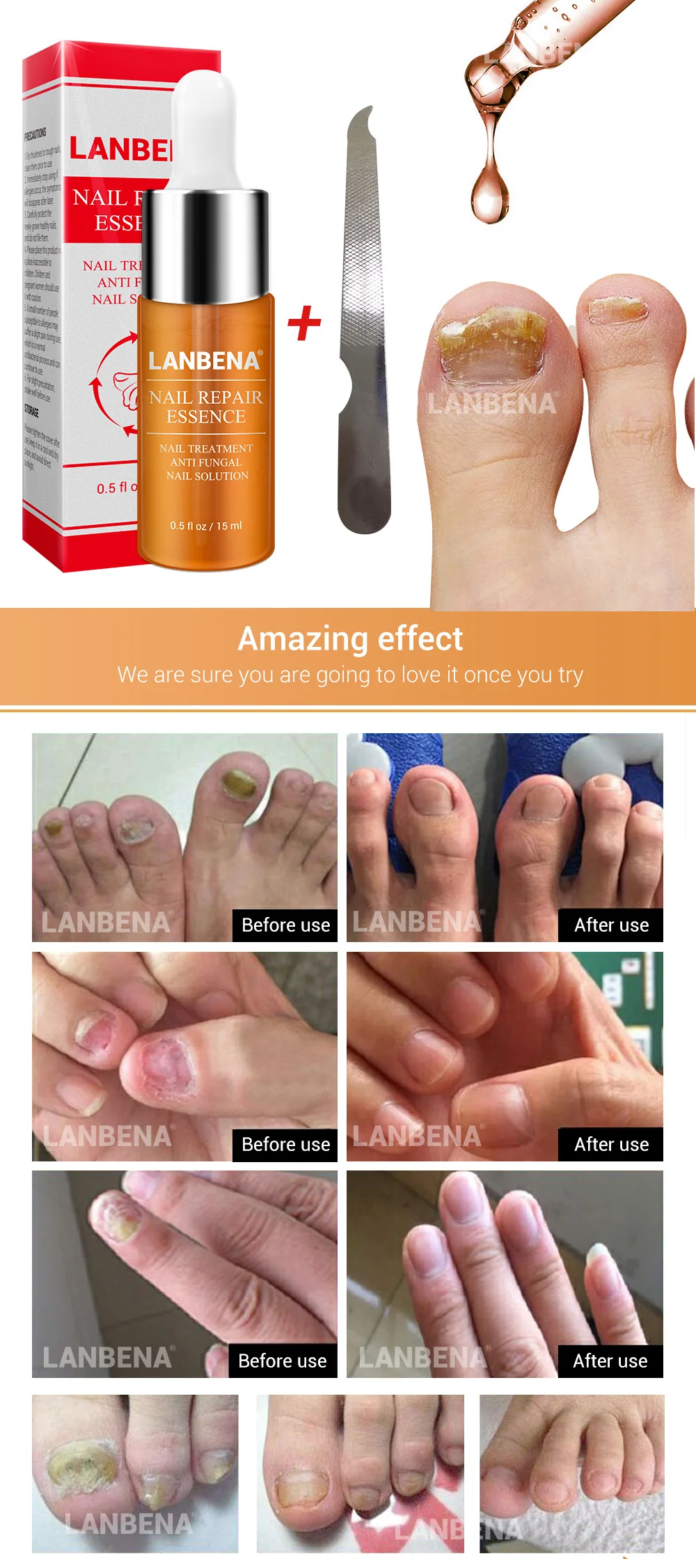 LANBENA средство для лечения грибковых ногтей, отбеливание ногтей и ног, удаление грибка ногтей, уход за ногами, гель для ногтей, набор инструментов для макияжа