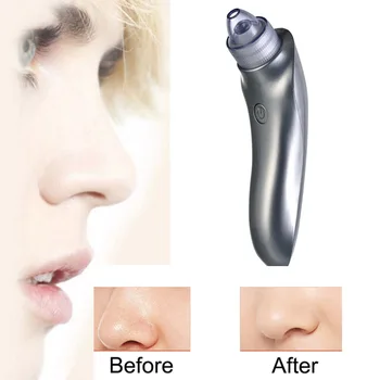 

Electric Face Pore Cleaner Blackhead Remover Vacuum Acne Comedo Suction Facial Skin Care Cleaning Beauty Machine TK-ing