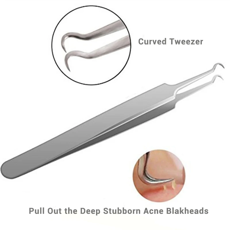 best blackhead extraction