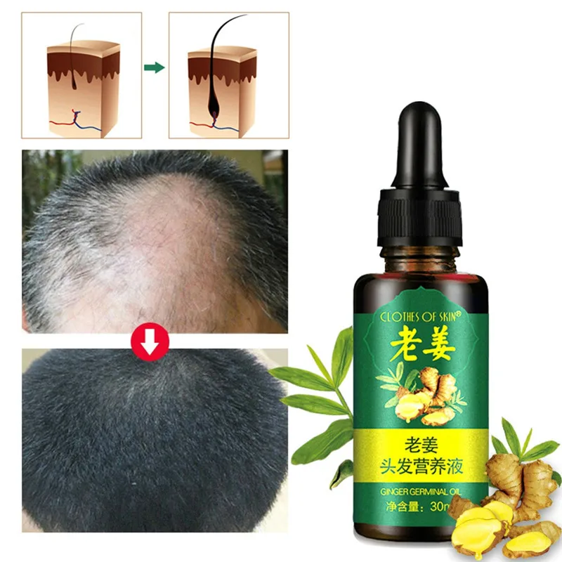 

Natural Essential Oil Fast Hair Growth Fluid Hair Growth Healthy Hair Loss Treatment Growth fluid essential oil dropship Jan8