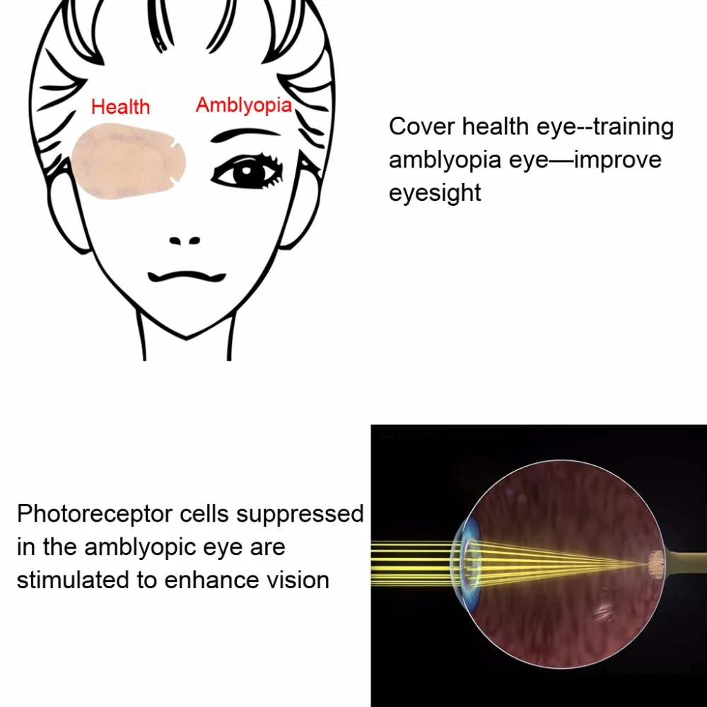 100 шт. патчи для глаз амблиопии для детей, ортопедические, ленивые, коррекция глаз, тренировка и послеоперационное покрытие для глаз пожилых людей