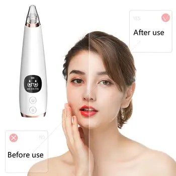 

Electric Blackhead Vacuum Cleaner Suction Facial Skin Care Removal Scar Acne Pore USB Rechargeable With LCD Display Portable