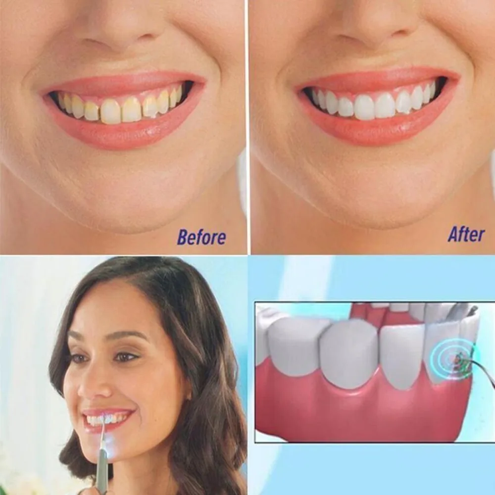 Электрический Очиститель зубов, Электрический стоматологический инструмент для удаления зубного камня, отбеливающий стоматологический инструмент для чистки зубов, светодиодный светильник