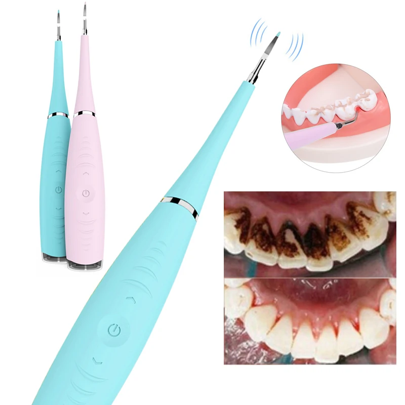 

Teeth Whitening Home Use Tooth Stain Remover Tartar Teeth Stains Scaling USB Charging High Frequency Vibration Dentist Tools