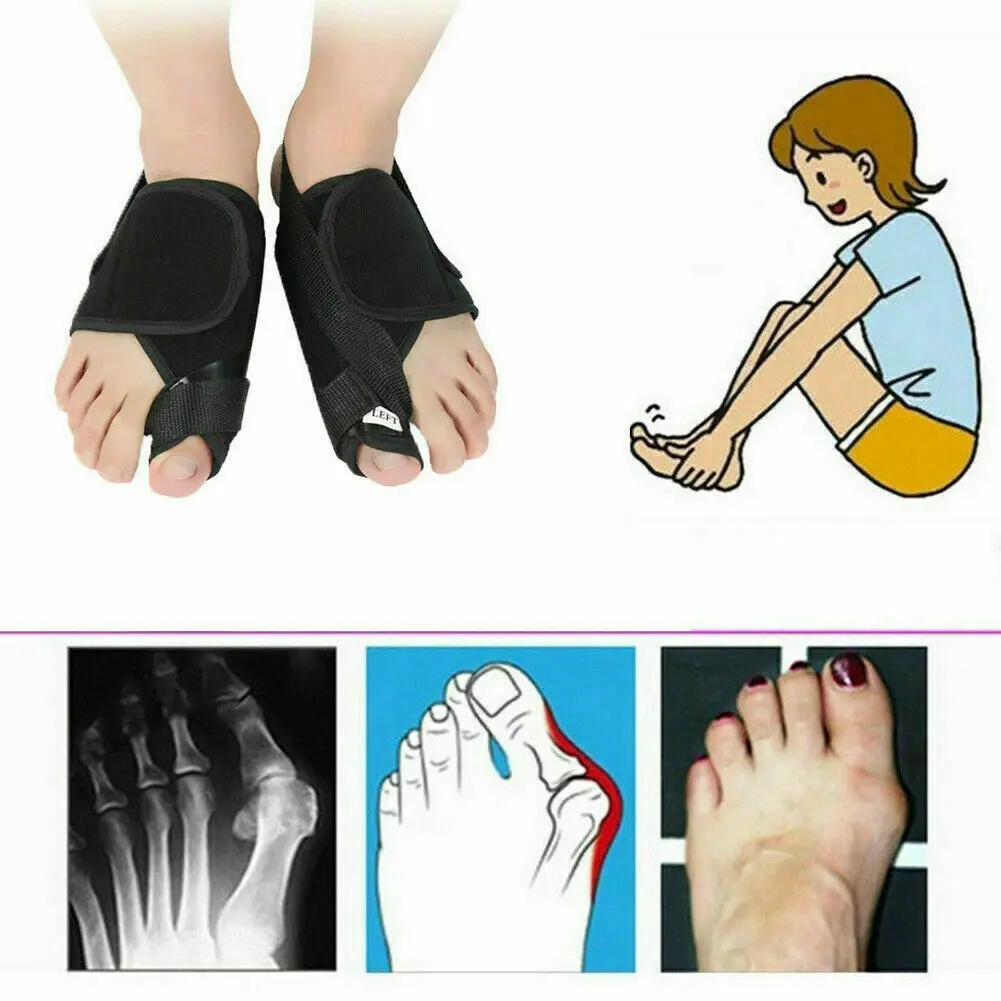 2 шт. = 1 пара приспособление для устранения деформации пальца на ноге Bunion корректор ортопедический для ног Коррекция педикюра