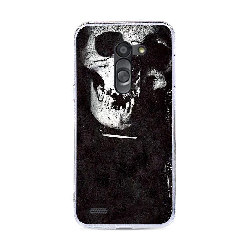 J&R Transparent Clear Phone Case For LG L Bello D331 D335 L Prime D337 Silicone Back Cover Cartoon Animals Flower Plants Cases