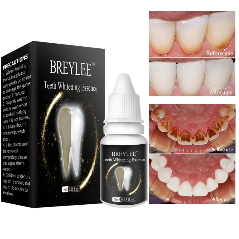 

BREYLEE Teeth Whitening Essence Oral Hygiene Cleaning Serum White Gel Teeth Care Tooth Bleaching Dental Tools Perfect Smile 2pcs