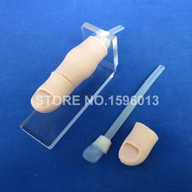 LV6-1 Ingrowing Toenail (5)