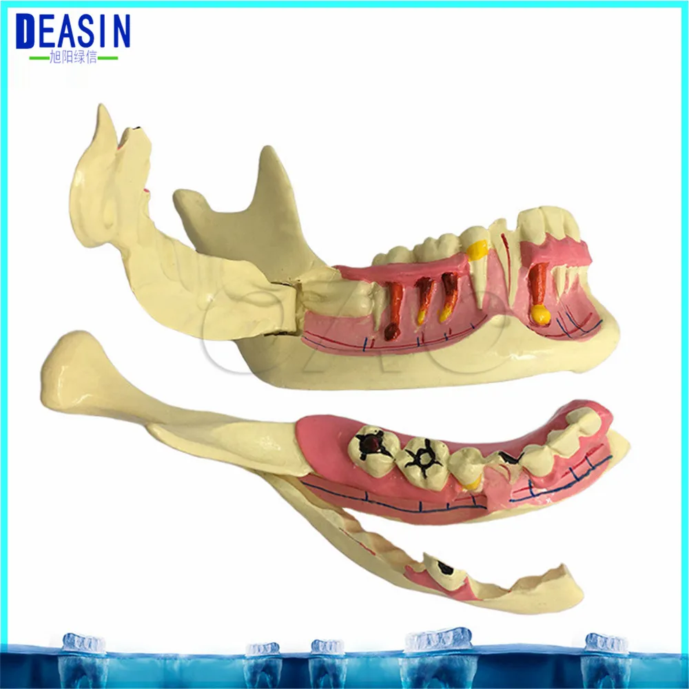 Высокое качество нижней челюсти модель для стоматологической Связь Модель Стоматологическая модель обучения