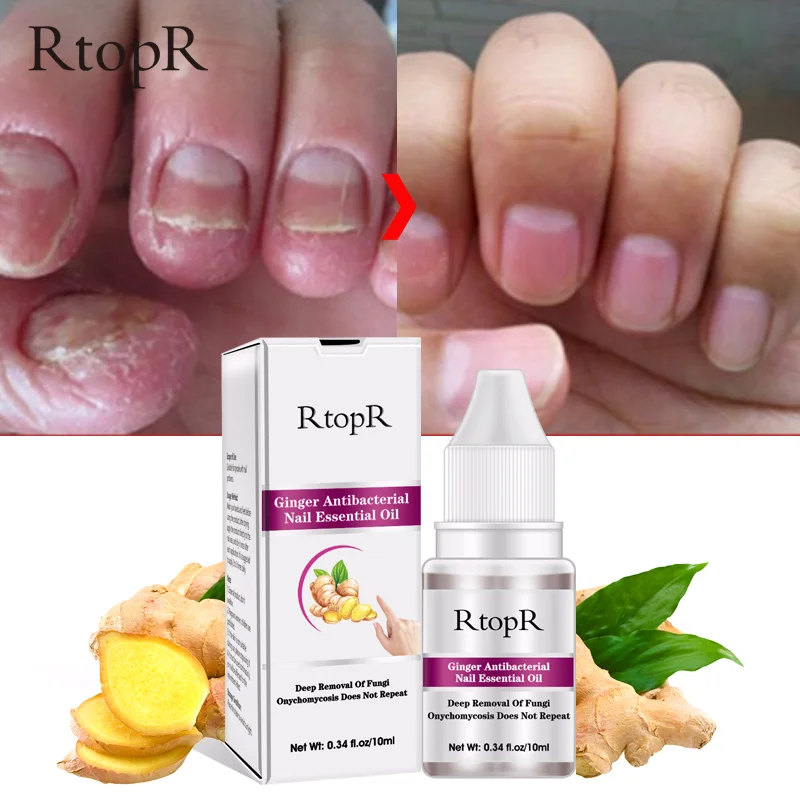 

Nail Repair Essence Serum Fungal Removal Onychomycosis Toe Nail Nourishing Brightening Hand and Foot Care Nail Treatment TSLM1