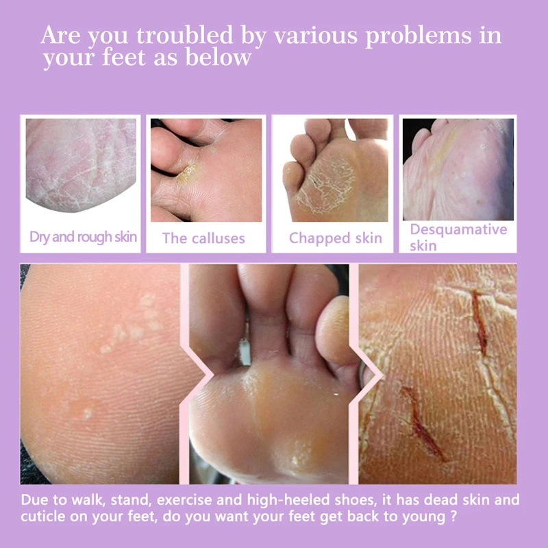 Cuidados com a Pele Máscara para Pés Meias para Pedicure Efero Pces Par Pés Peel Máscara Remover Mortos Suave Esfoliante pé Spa 24 = 12 3 peel máscara remover cuidados com a pele