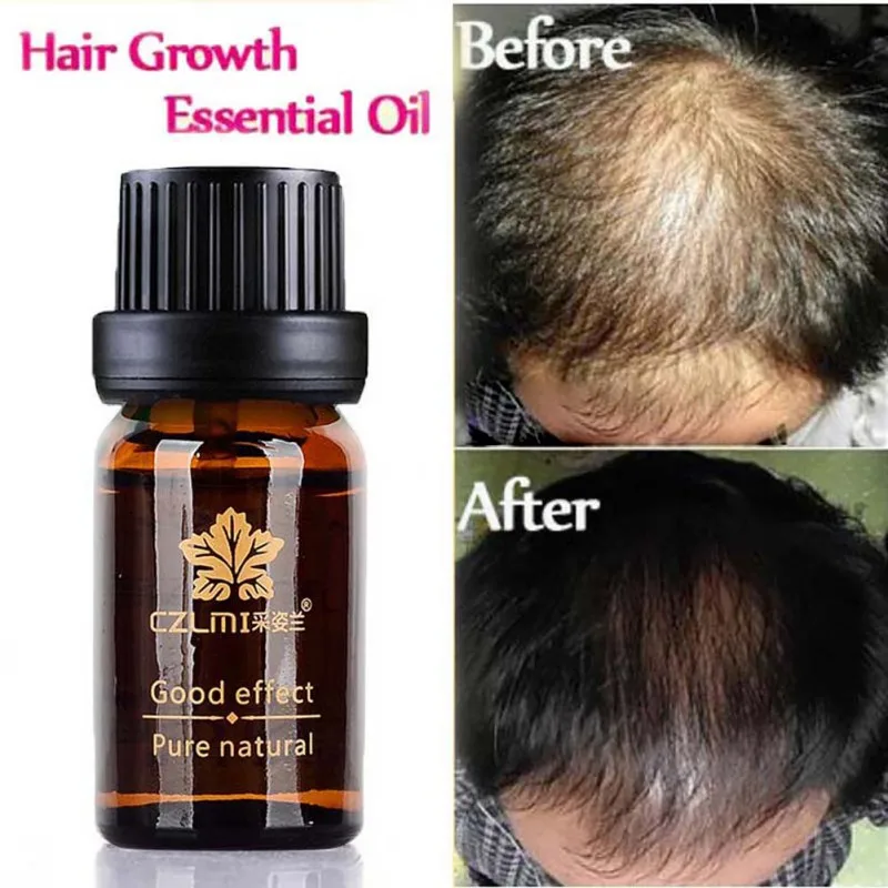 Aliexpress.com : Buy Anti hair Care Essential Oil Pure ...