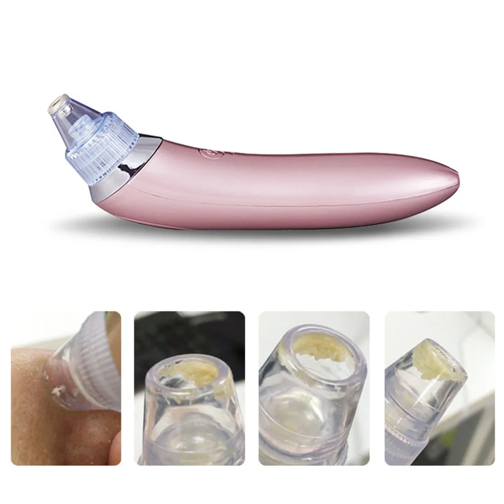 Electric Acne Remover Point Noir Blackhead Vacuum Extractor Tool Black Spots Pore Cleaner Skin Care Massager Face Lift Tool Kit