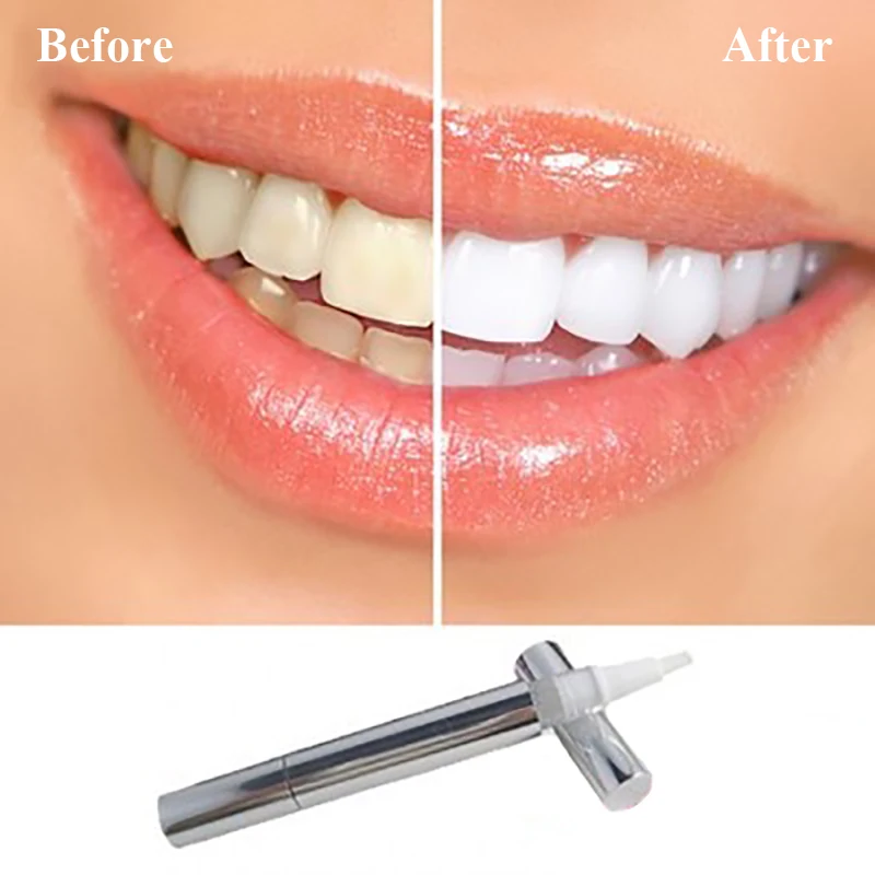 

2 Pieces Hot Creative Effective Teeth Whitening Pen Tooth Gel Whitener Bleach Stain Eraser Sexy Celebrity Smile Teeth Care