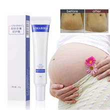 Гладкий крем для кожи, жир, морщины, удаление беременности для беременных, ремонт кожи, крем для тела, мягкая кожа, растягивающиеся пятна, шрам, удаление кремов