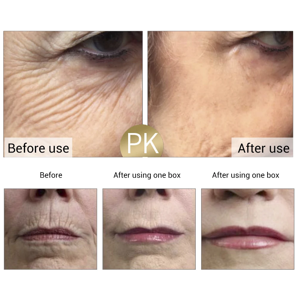 LANBENA 24K gold peptide wrinkle facial ampoules Capsule face cream day skin whitening Sera Anti-Aging lifting firming 30 grains LANBENA 24K gold peptide wrinkle facial ampoules Capsule face cream day skin whitening Sera Anti-Aging lifting firming 30 grains