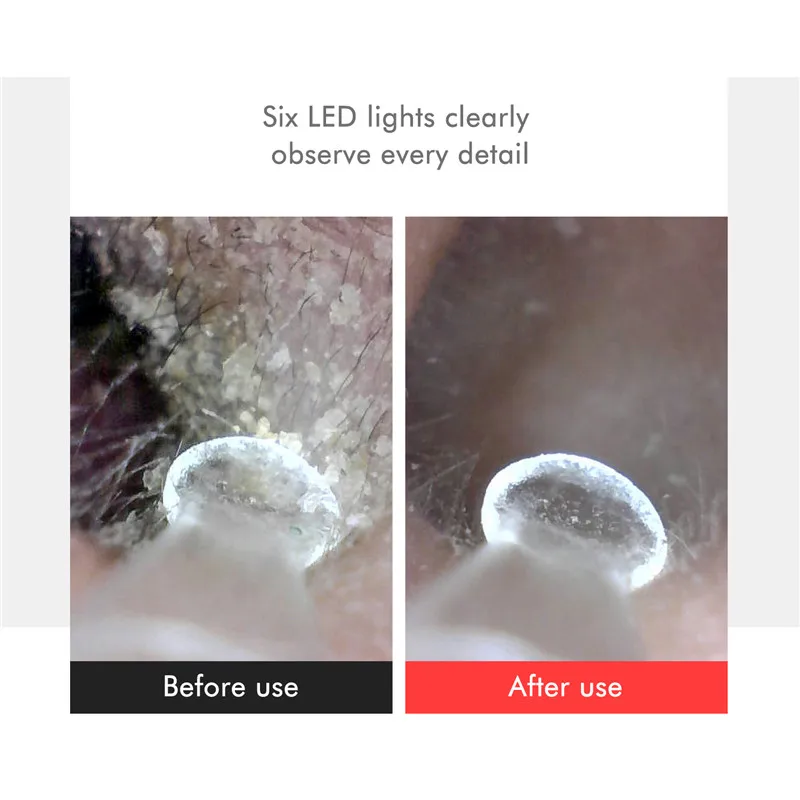 Antscope Wifi Ear Cleaning Otoscope интегрированный мм безопасные с медицинской точки зрения