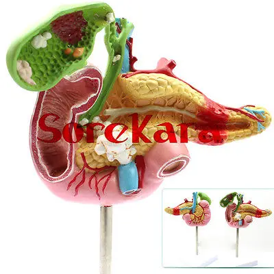 

1:1 Human Anatomical Duodenum Gall Bladder Disease Anatomy Medical Model School Hospital New