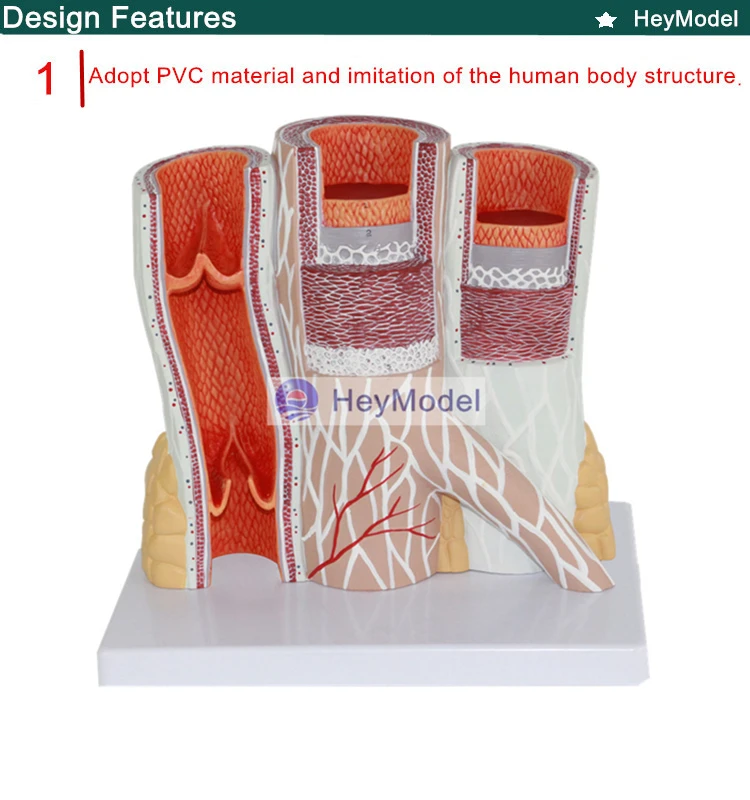 1.PVC_