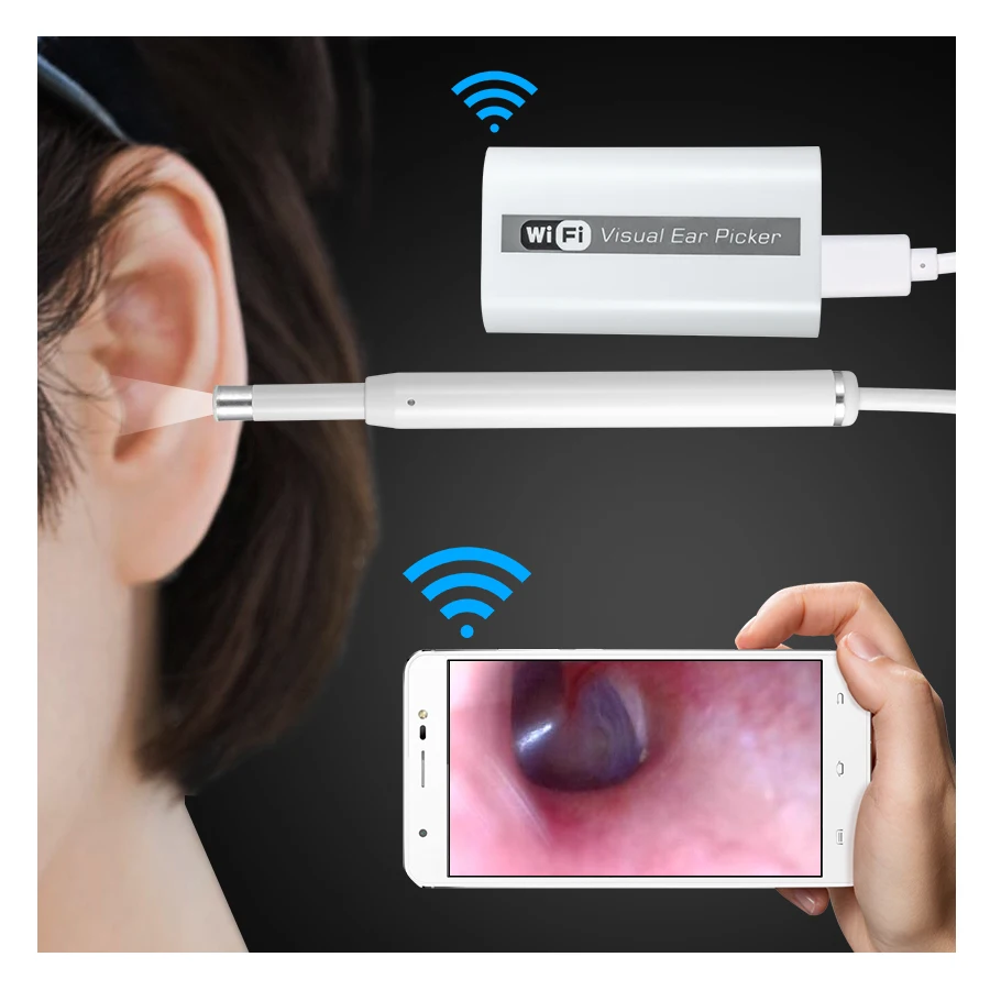 FUERS 720P HD Multipurpose Otoscope USB WiFi Endoscope Mini Camera Ear Cleaner Borescope Support PC MAC Android IOS Phone FUERS 720P HD Multipurpose Otoscope USB WiFi Endoscope Mini Camera Ear Cleaner Borescope Support PC MAC Android IOS Phone