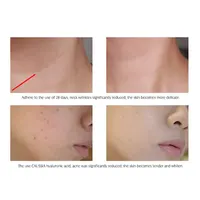 ARTISCARE Hyaluron Acid Serum 10pcs/Lot for Face Moisturizing and Hydrating Skin Care Essence Facial Care 4