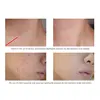 ARTISCARE Hyaluronic Acid Face Serum 5pcs for Moisturizing and  Brighten Long-Lasting Hydrating Skin Care Essence 4