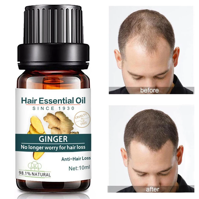Natural Pure Origina Essential Oils 10ML Dense Hair Growth Serum Health