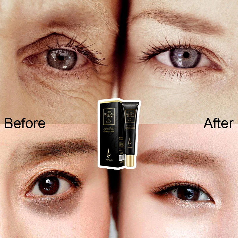 

ROREC Hyaluronic Acid Eye Cream Anti Puffiness Remove Dark Circles Anti Wrinkles Eye Essence Cream Anti Aging Gel