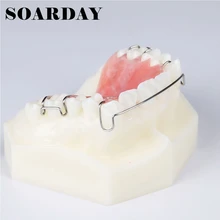 Зубные фиксатор демонстрация модели ортодонтия Лечение модель