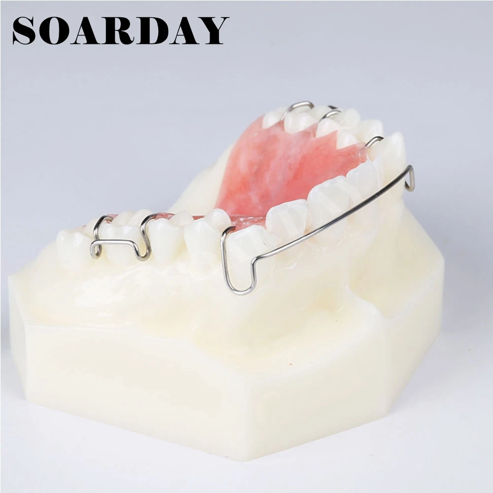 Dental Retainer Demonstration Model Orthodontics Treatment Modelorthodontic modeldental