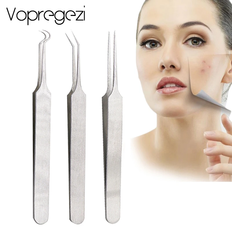 Vopregezi 1PC Stainless Steel Acne Needle Remover Blackhead Removal