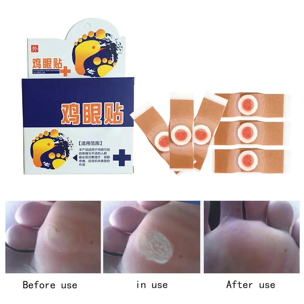 

12PCS Foot Corn Remover Plaster Detox Foot Pad Patches Medical Patch Relieving Blisters Corn Friction Pain Foot Skin Care Tools