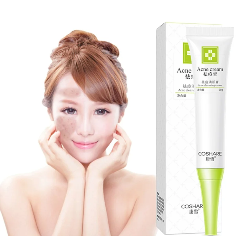 

Hot Aloe Vera Gel Hydrating Whitening Day Creams Acne Anti-acne Wrinkle Collagen Whitening Facial Cream Brighten Skin Care
