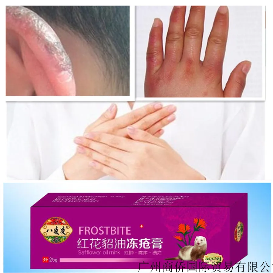 Anti itching Frostbite Anti Cracking Cream Hands And Feet Antifreeze