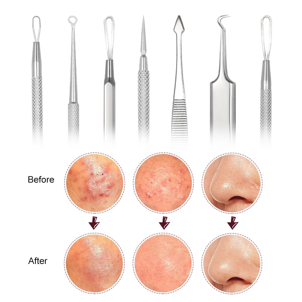 7 шт. прибор для удаления черных точек инструмент набор для ухода за лицом Удаление прыщей инструменты пятна удалитель акне иглы клип набор пинцетов по уходу за кожей лица