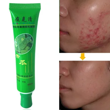 

Mild Non-stimulus Face Cream Face Skin Repairing Beauty Product Acne Cream Oil Control Acne Remover Clear Up Pimples Facial Care