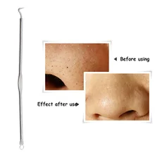 10 шт. комедонов игл для прыщей Blackhead инструменты для снятия точечный очиститель пор инструмент для удаления Blakchead Съемник Уход за лицом для очистки