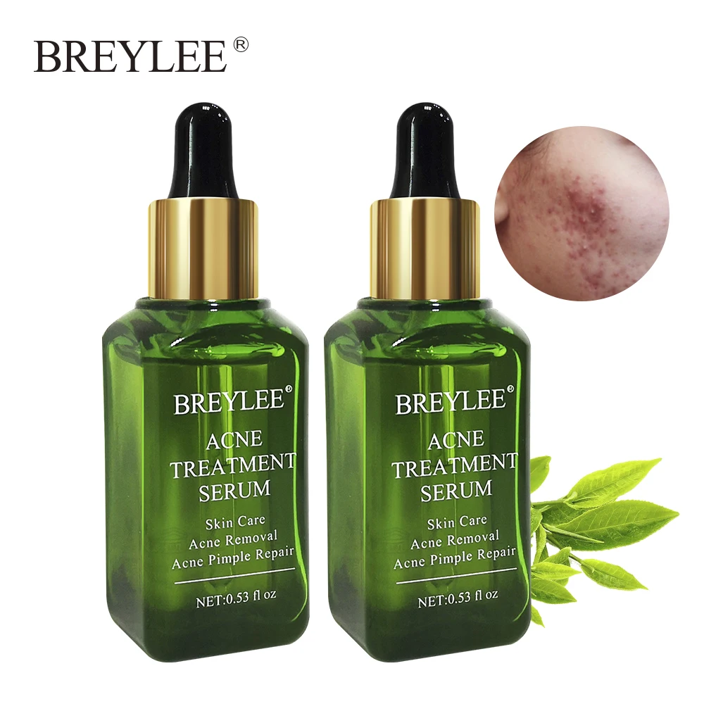 BREYLEE 2PCS Acne Treatment Serum Natural Facial Essence Acne Scar Removal Face Skin Care Whitening Repairing Pimples Remover