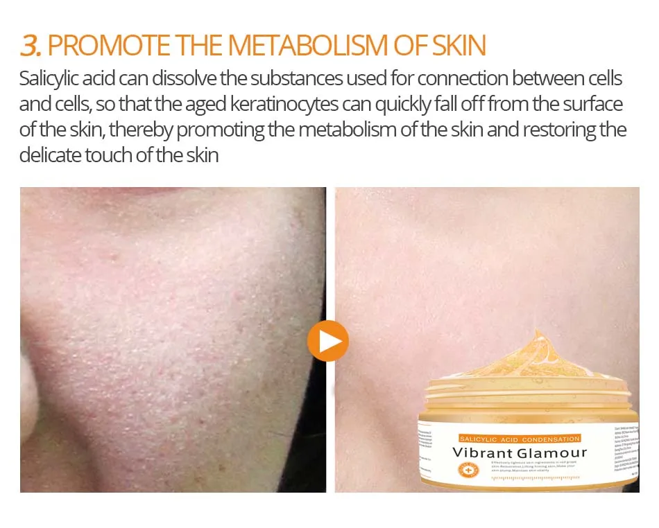

VIBRANT GLAMOUR Salicylic Acid Perfect Gel Mask Cream Shrinkage Pore Control Oil Acne Moisturizing Skin Care TSLM1