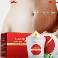 Крем для тела для восстановления кожи материнства, чтобы удалить удаление растяжек шрамов послеродовой уход, сыворотка для беременных, гладкая кожа