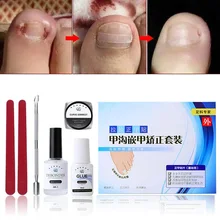 Набор инструментов для ухода за ногами, выпрямляющий зажим для вросших ногтей, изогнутый пластырь, клей для наклеек, фиксатор для пальцев ног, инструмент для коррекции