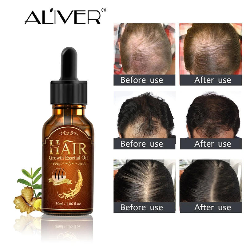 Aliver Hair Growth Essence Hair Loss Liquid Natural Pure Origina Essential  Oils 20ml Dense Hair Growth Serum Health Care Beauty - Hair Loss Product  Series - AliExpress