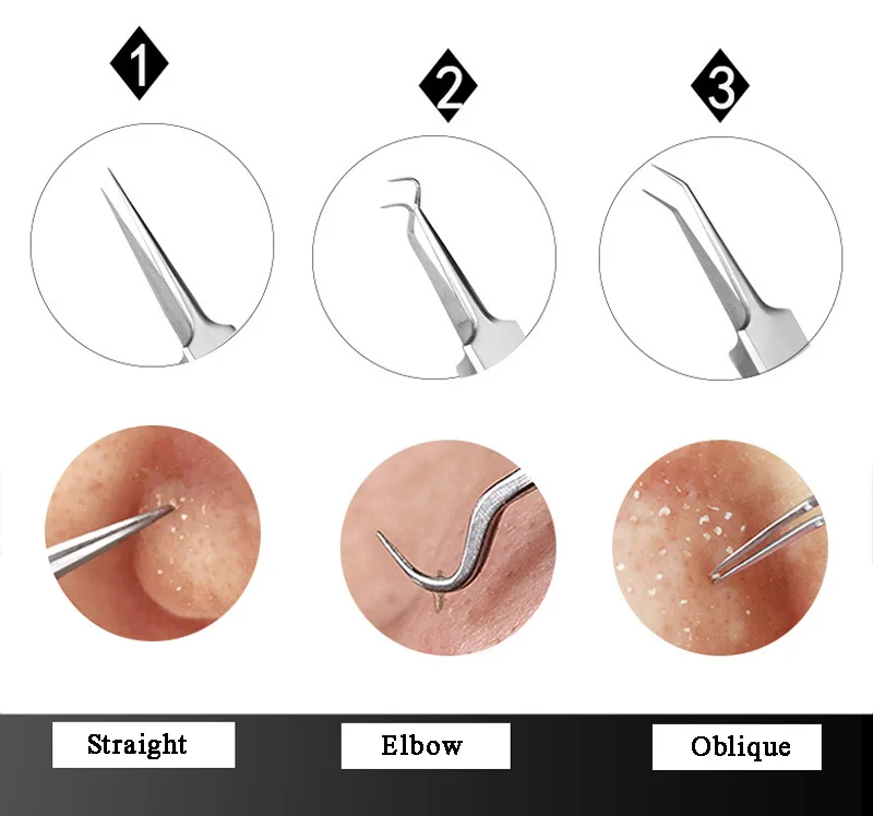 Профессиональная игла для удаления прыщей Пинцет Набор для ухода за лицом инструмент для удаления черных точек и пятен