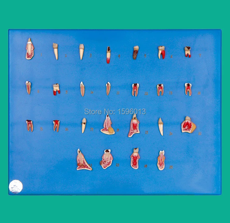 Dental Diseases Model, Dental pathology series model, teeth disease