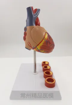 

educationTeaching model heart zone 4 stage vascular heart anatomy model heart blood vessel specimen heart structure
