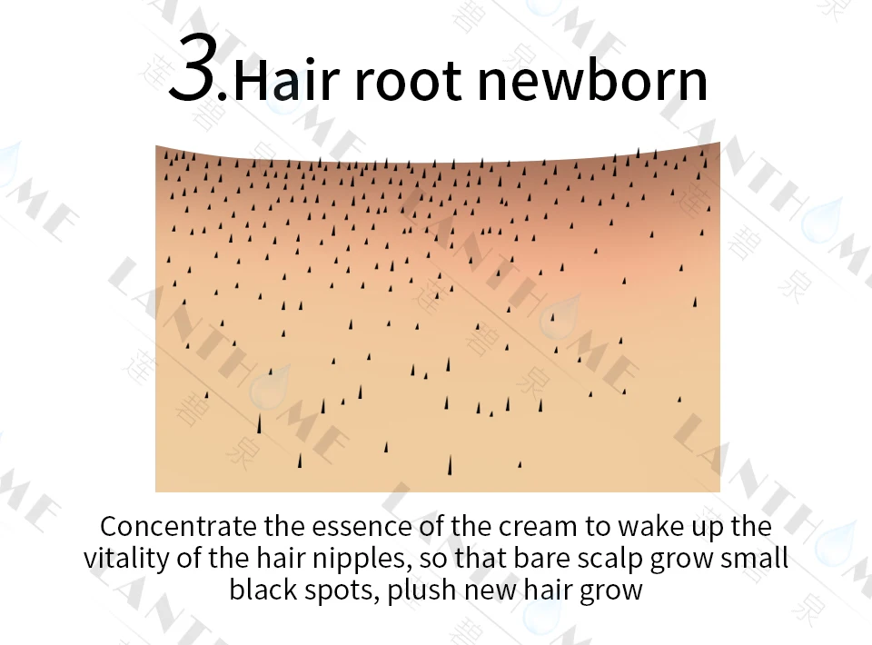 Lanthome борода рост волос жидкий спрей продукт шампунь для женщин и мужчин кератин Уход за волосами против облысения лечение падения волос