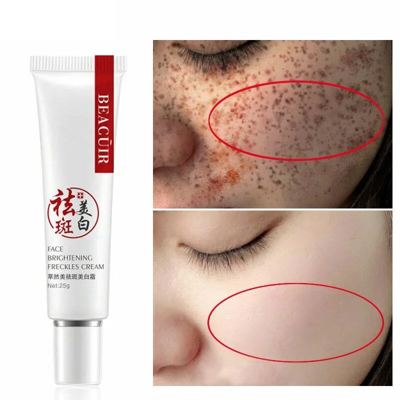 

Freckle Cream for Anti-wrinkle Face Stains Dark Spot Skin Pigmentation Skin Whitening Cream QS888