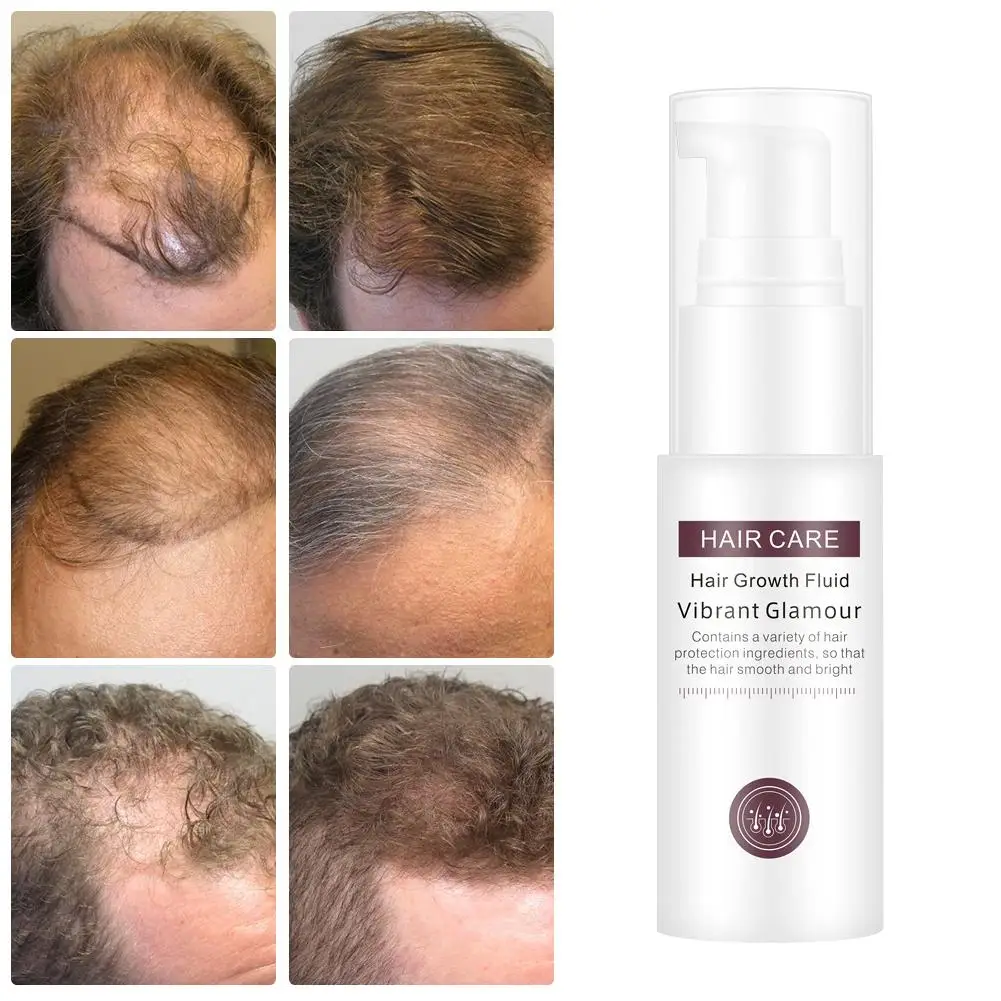 

Hair Growth Essence Essential Oil Liquid Spray Nourish Roots Thick Shiny Prevent Hair Loss Anti-hair For Men Women Hair Care
