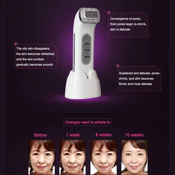 

Radio Frequency Lifting Face Remove Wrinkles Skin Care Beauty Massager Tightening Device Health99